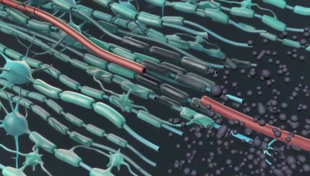Mechanisms of Secondary Spinal Cord Injury- A 3D scientific animation ...