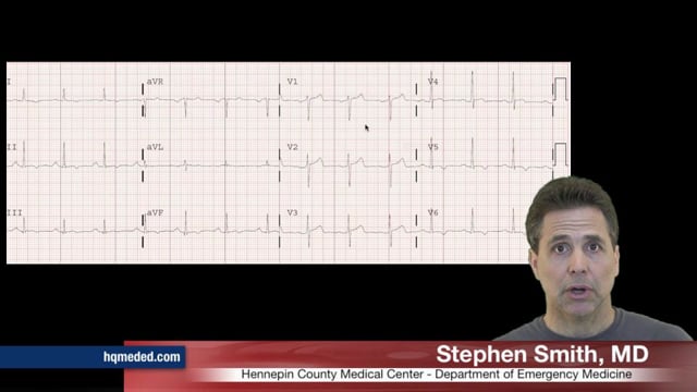 HQMedEd - T-wave Inversion on Vimeo