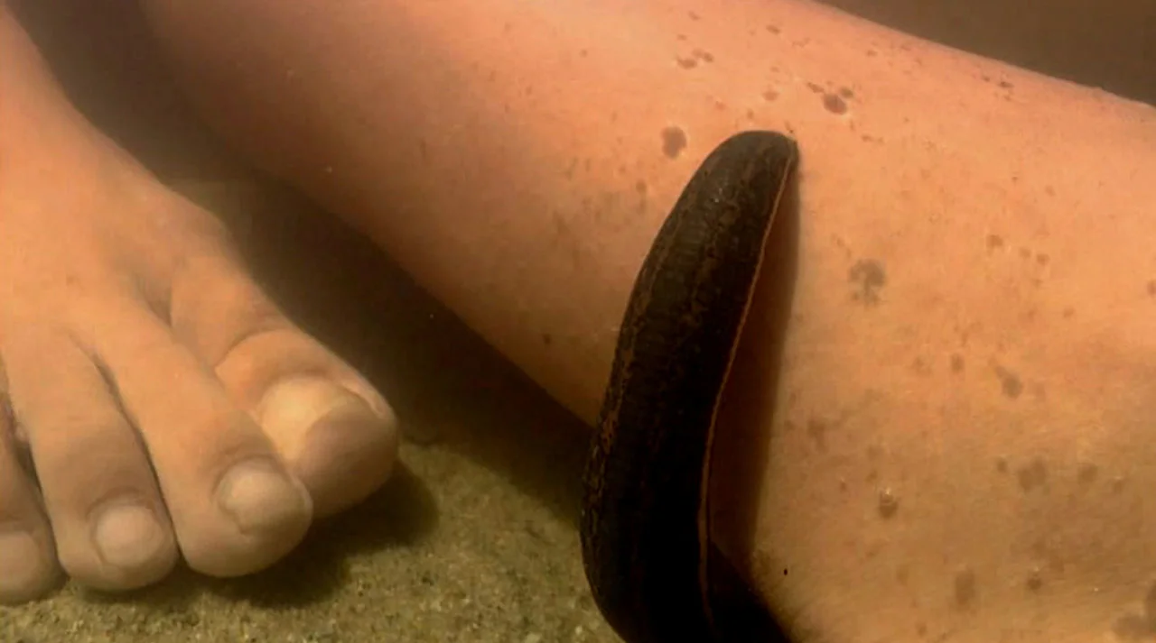 Annelids:  Leeches  