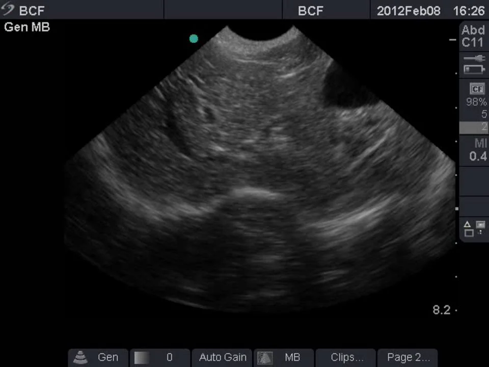 Sonosite MicroMAXX Canine Liver Transverse C11 from BCF Technology on Vimeo