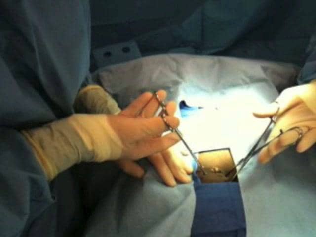 Postpartum Tubal Ligation Minilaparotomy Technique on Vimeo