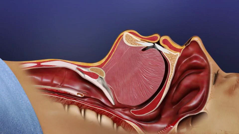 Siesta medical ENT animation - 3D Scientific Animations on Vimeo