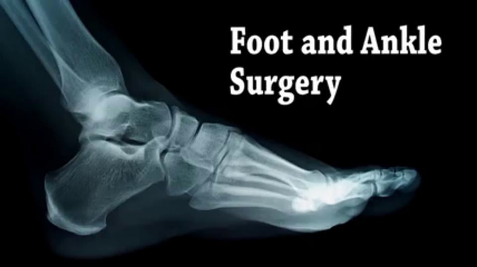Foot Surgery and Ankle Surgery - NYC Podiatrist Lower Manhattan - Jerry ...