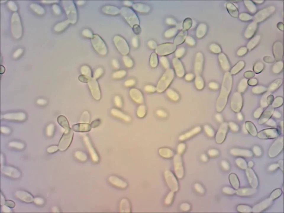 Кандиды погибают. Кандида альбиканс под микроскопом. Грибок кандида под микроскопом. Candida kefiri под микроскопом. Candida ethanolica под микроскопом.