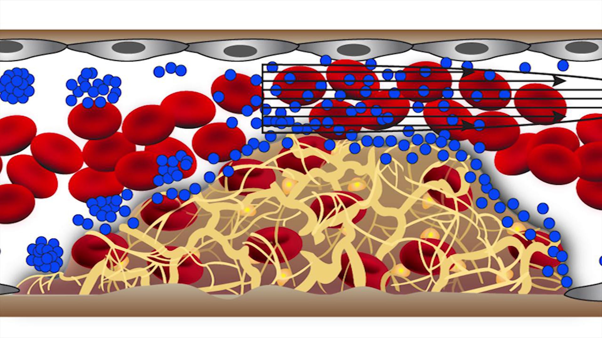 Clot-busting nanotherapeutic