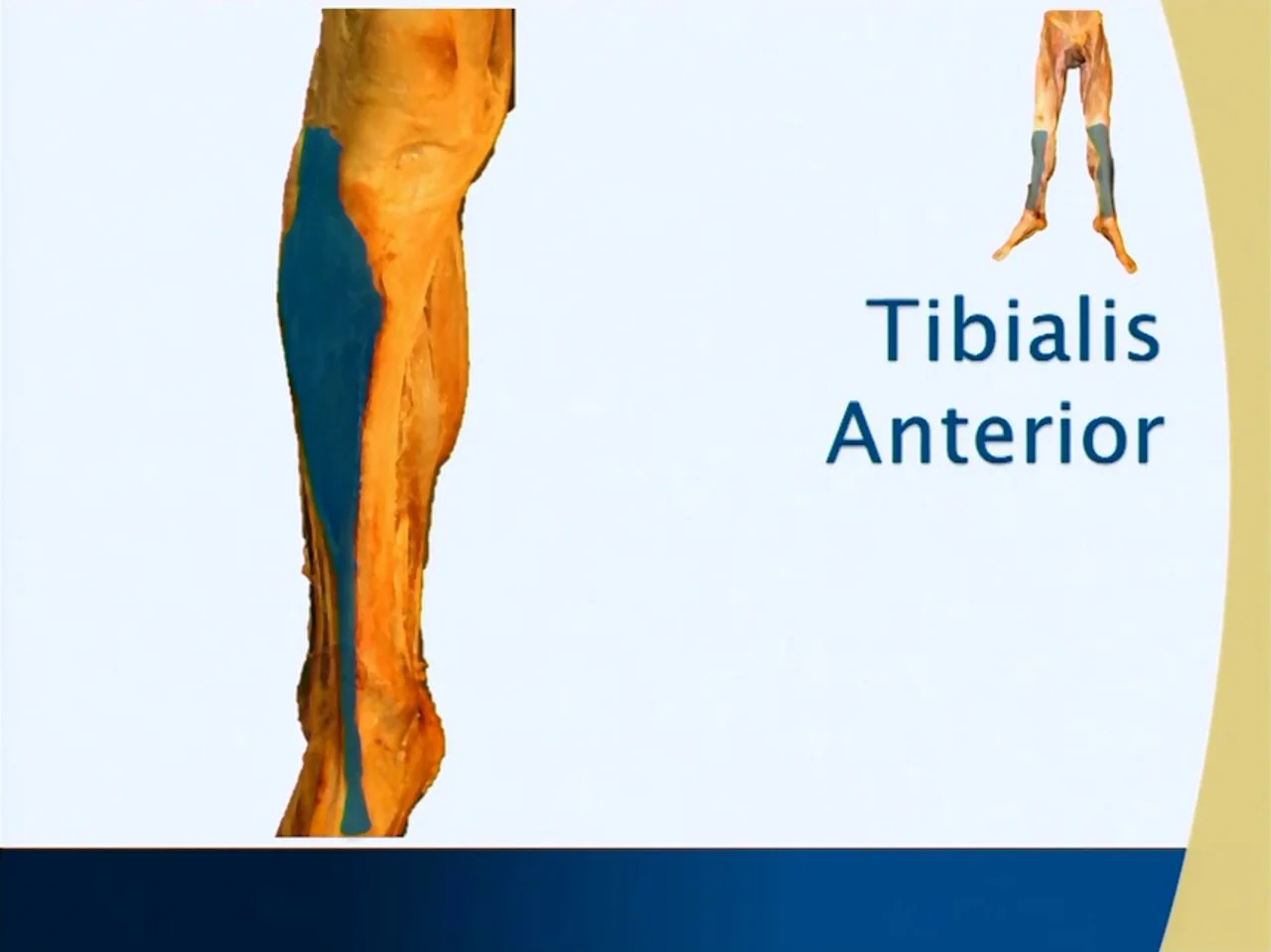 Muscle Chart: Tibialis Anterior (Anterior Leg), image size:1280x959