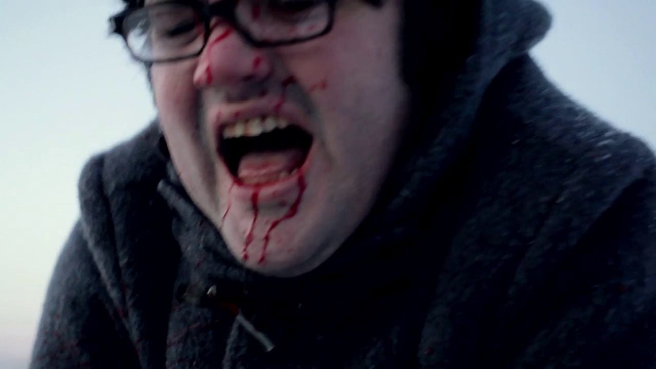 Nick Rutter Director - Myxomatosis on Vimeo