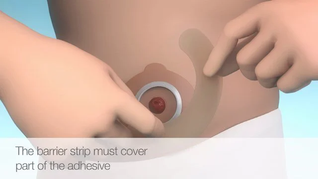 Brava Adhesive Remover Wipe on Vimeo