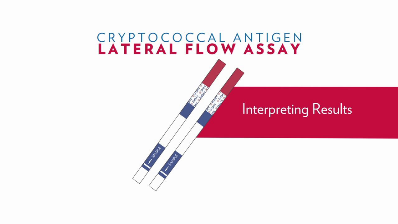 IMMY's Cryptococcal Antigen Lateral Flow Assay Training Part 1 of 2