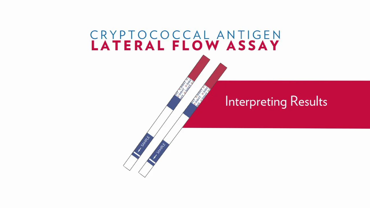 IMMY's Cryptococcal Antigen Lateral Flow Assay Training Part 1 of 2 on Vimeo