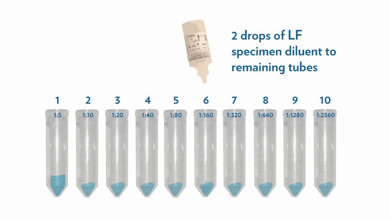 IMMY's Cryptococcal Antigen Lateral Flow Assay Training Part 2 of 2 on Vimeo