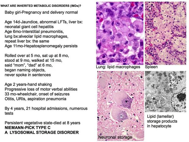 Niemann Pick Disease Type C: 'My healthy baby is dying and there's