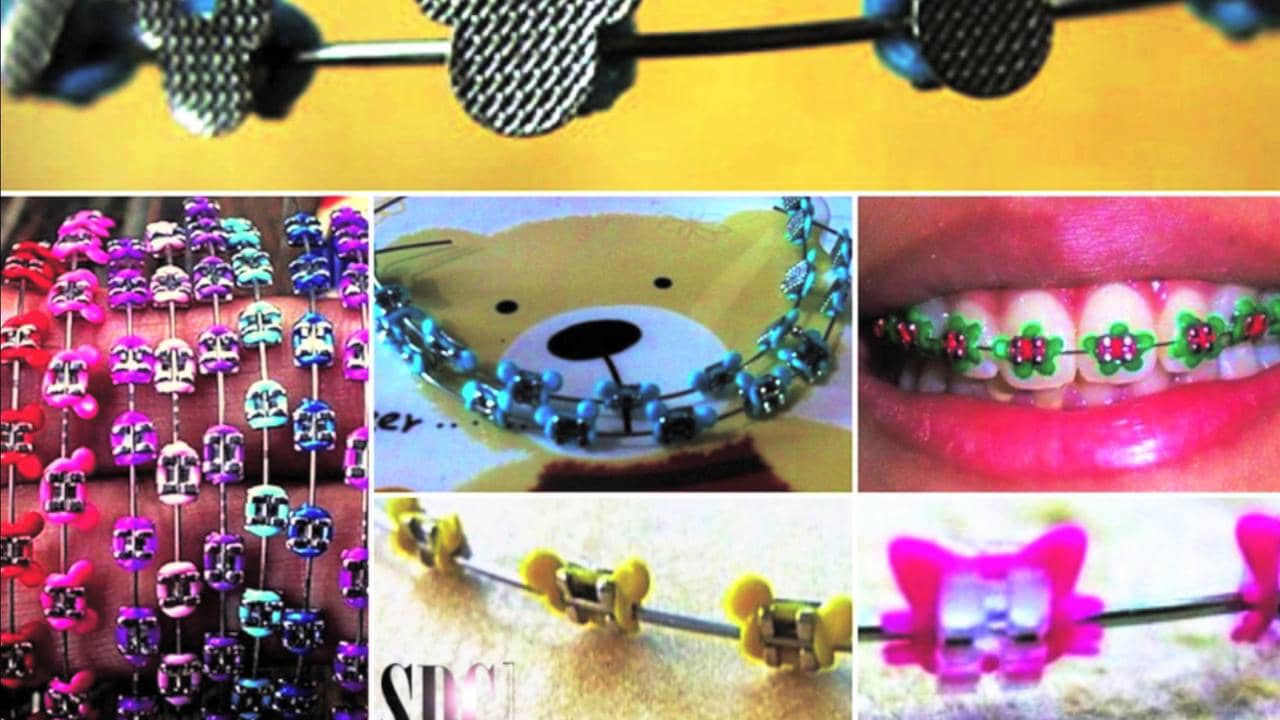 fashion braces , fake braces on Vimeo