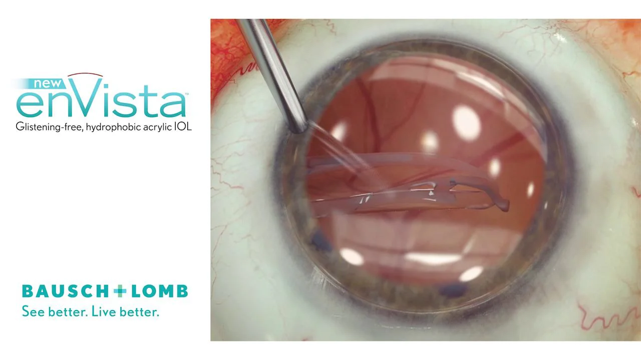 EnVista Intraocular Lens on Vimeo