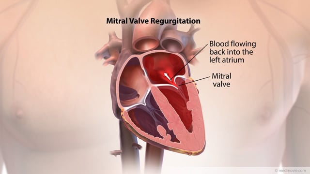 Piedmont Healthcare LV Myocardial Strain Workflow on Siemens SC200 on Vimeo