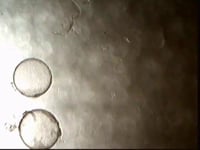 A Rare View of a Twin Embryo Extraction