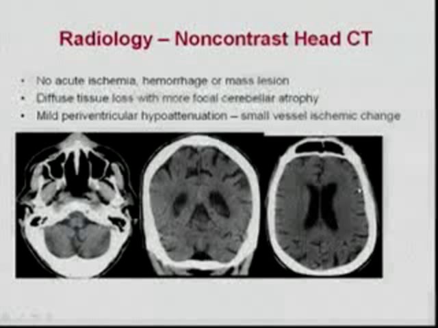 May 26, 2011 - NEJM: A 55 Year Old Man with Alcohol Dependence and Delirium