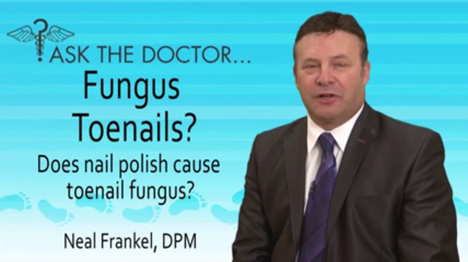 does-nail-polish-cause-toenail-fungus-podiatrist-in-chicago