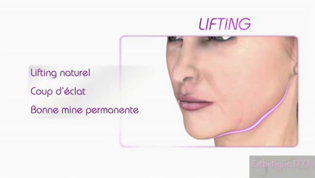 Le lifting cervico-facial
