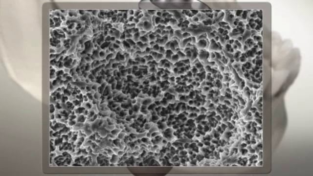 Vidéo : les implants dentaires