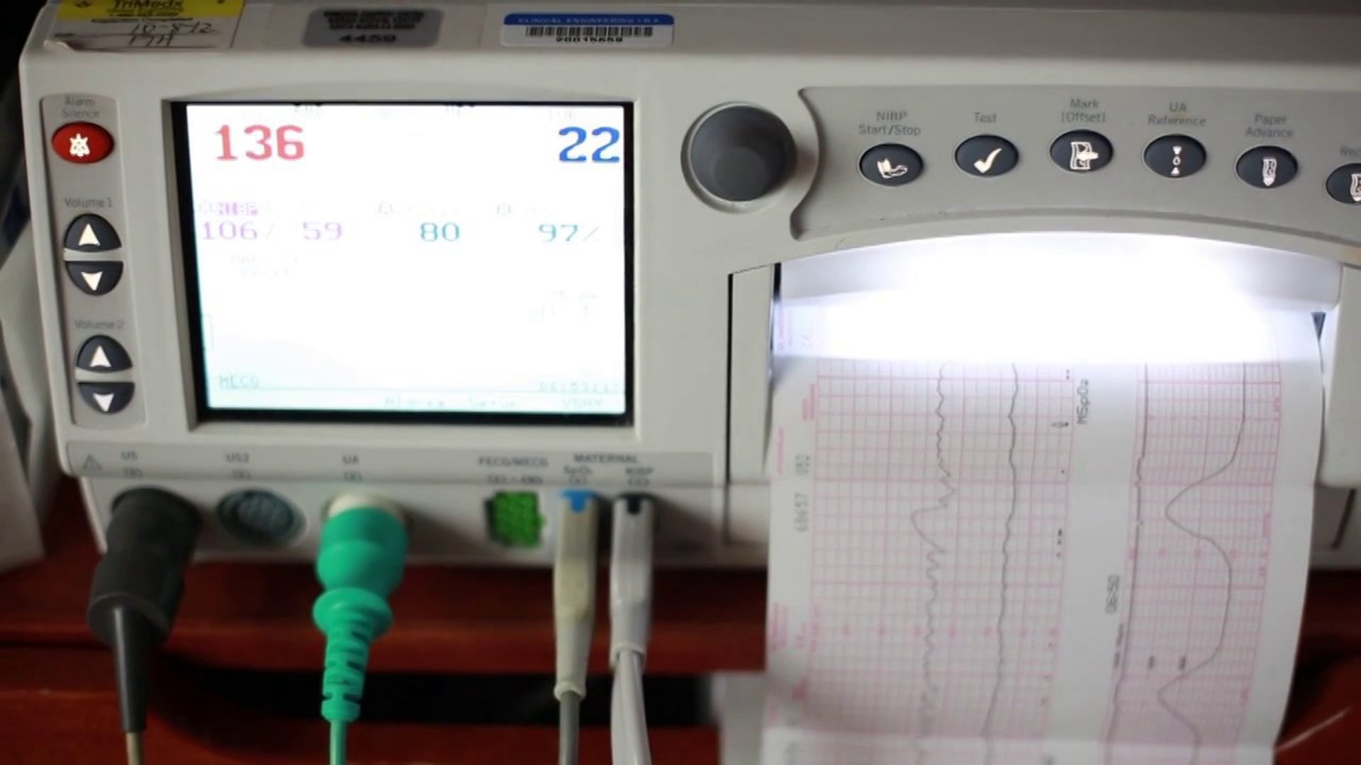 Marian Regional Medical Center Delivery Video