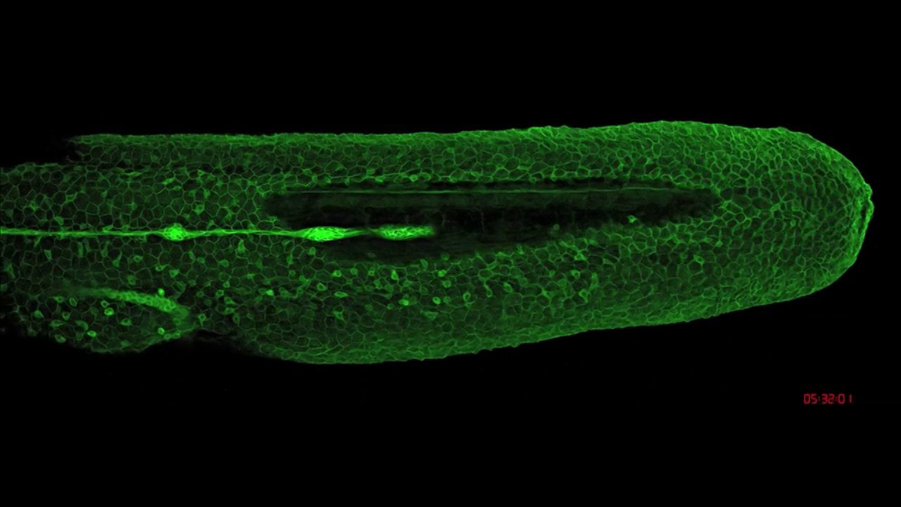 Zebrafish Lateral Line Migration - MBL Embryology Class of 2012