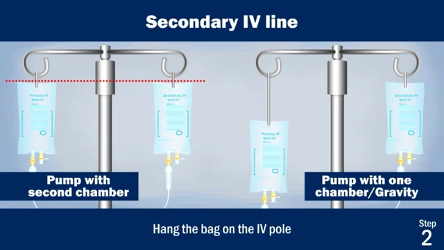 IV Piggyback Medication Administration