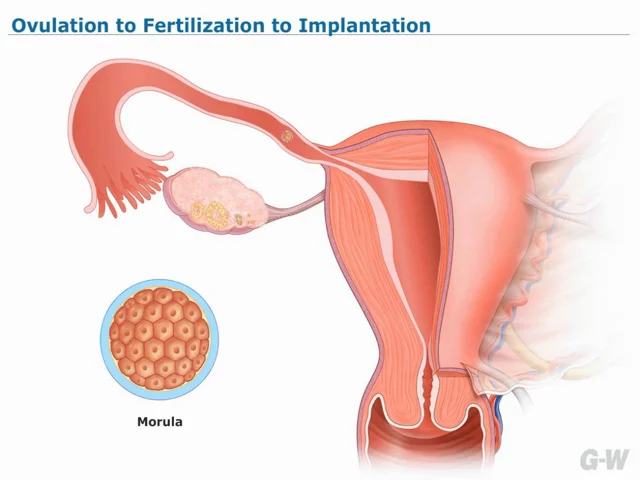 implantation diagram