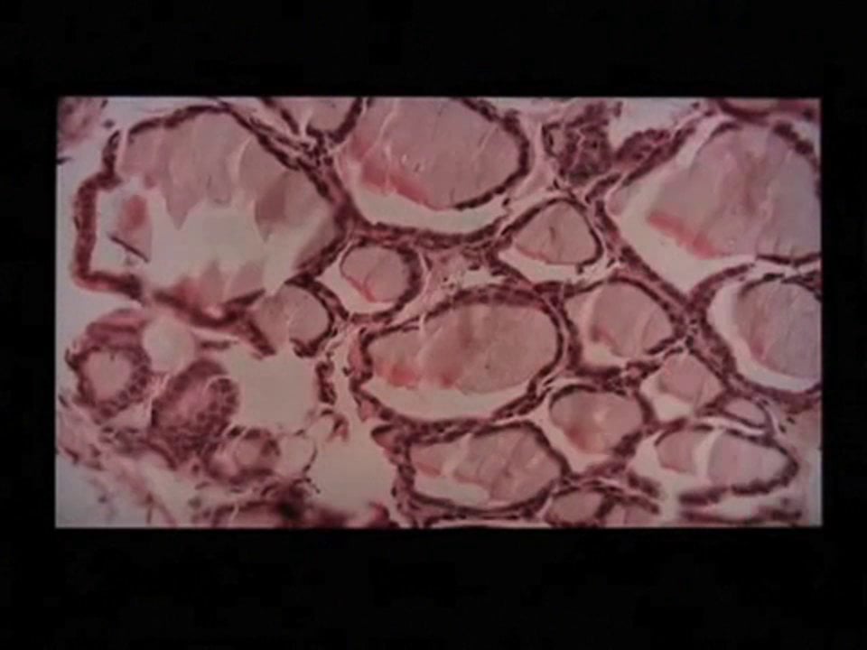 BIO 142- Endocrine Histogram Podcast on Vimeo