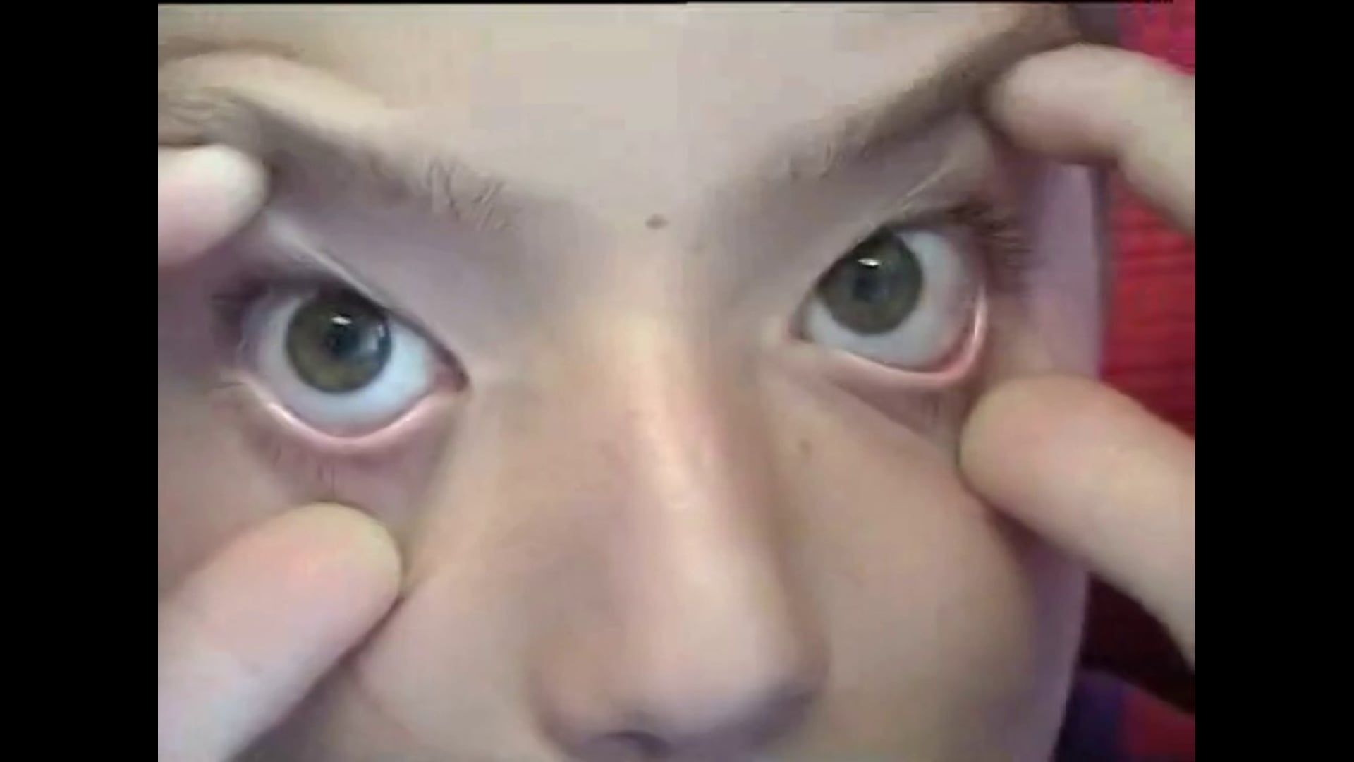 Poil aux yeux