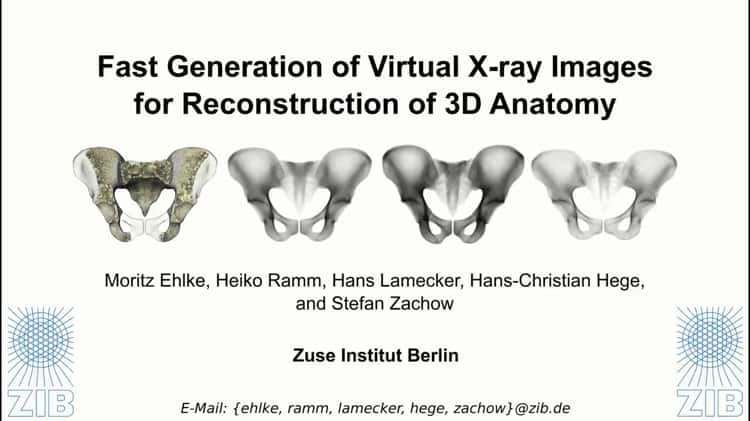 How To: EFAST - Pelvis 3D Video 