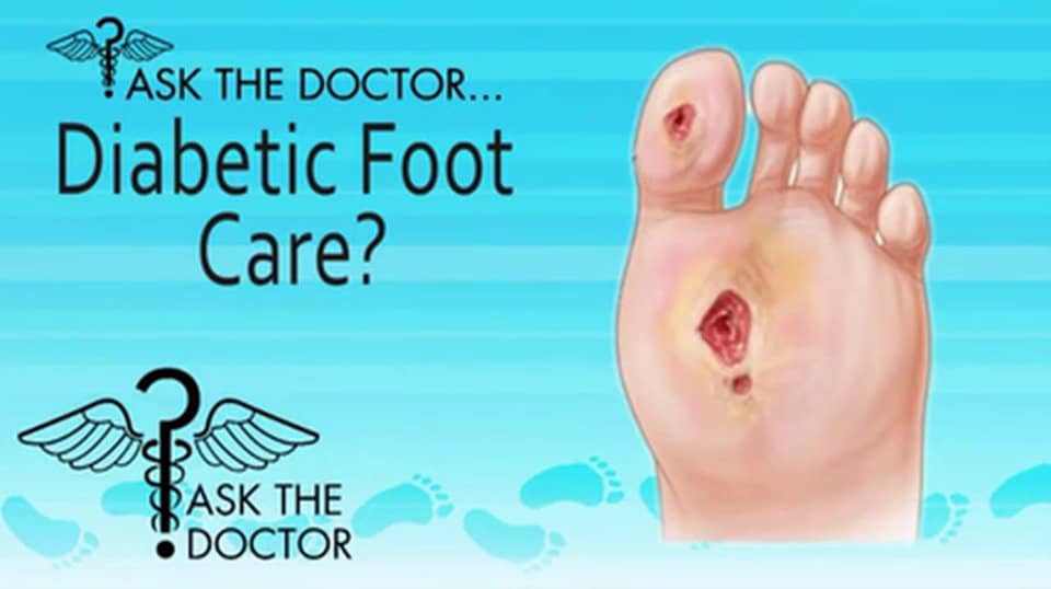 How Do I Know If I have Diabetic Neuropathy? Podiatrist in Spring Hill