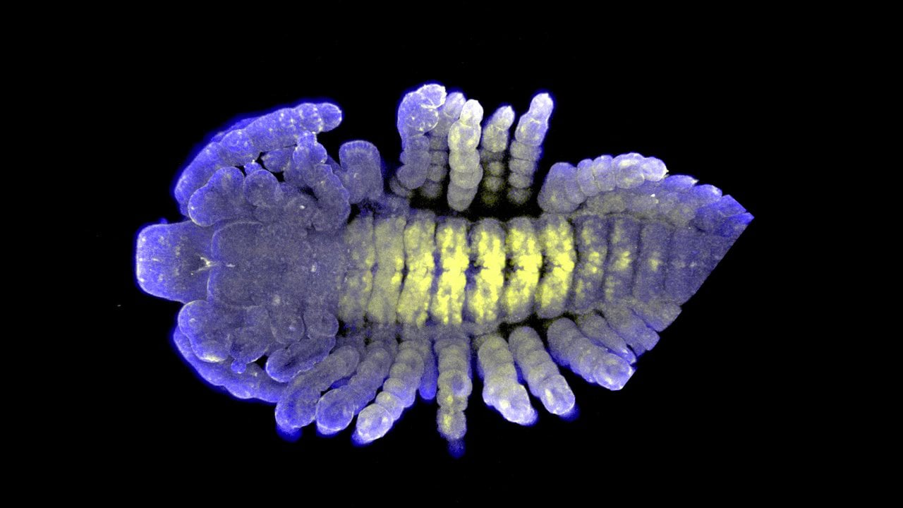 Parhyale embryo - Ubx & Anti-HRP; by Rachel Thayer