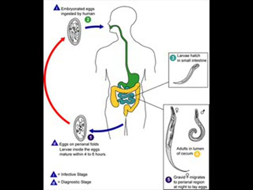 9-BIO-8 PINWORM DISEASE , HEALTH EDUCATION , INFECTION CONTROL (ICSP ...