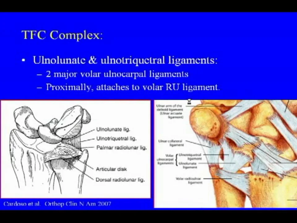 Department of Radiology - Conference Videos - Anatomy Wrist TFCC ...
