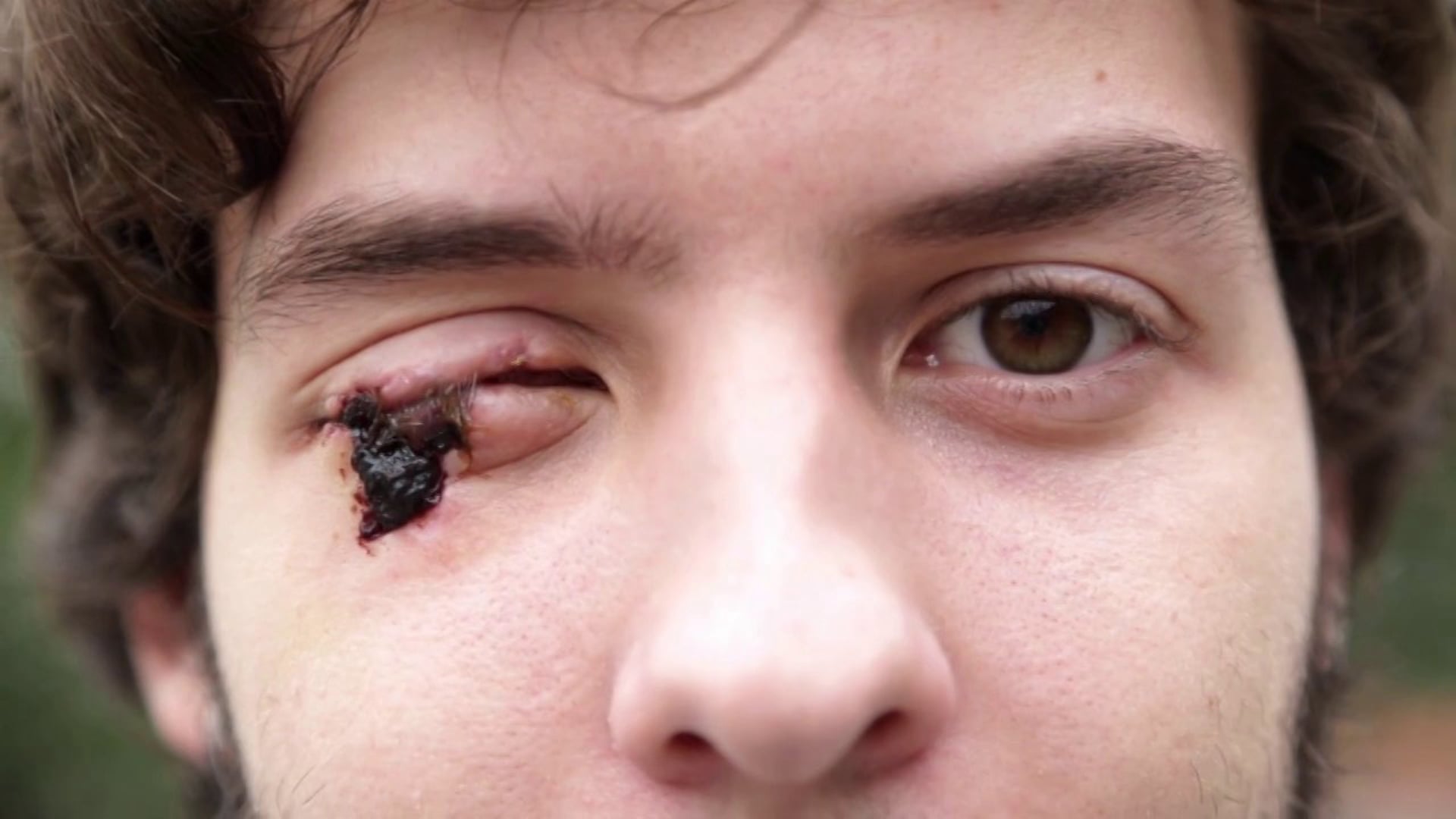 Brazilians blinded by riot police speak out