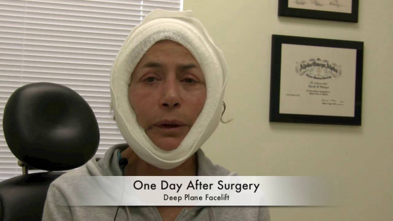 Recovery After Facelift Surgery Bandages on Vimeo