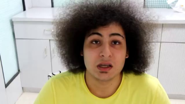 ADHI Best Hair Transplant in India on Vimeo