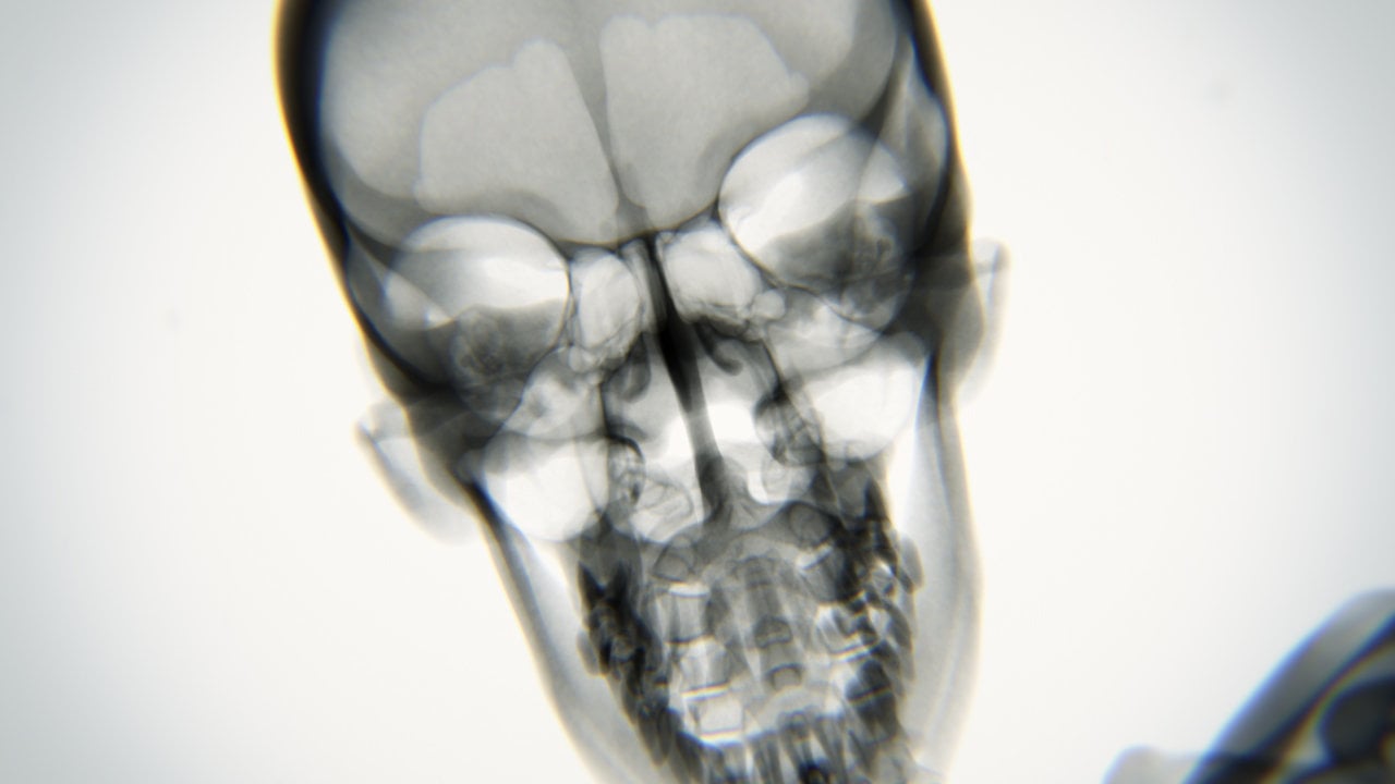 Issiq etuk erotik video kompilyatsiya