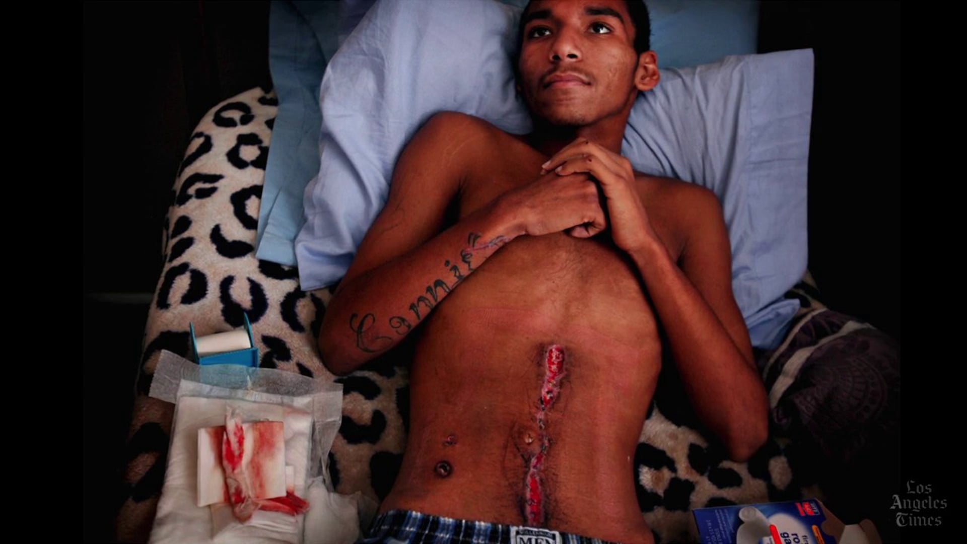 Surgeon races to save a life in L.A.'s shooting season.