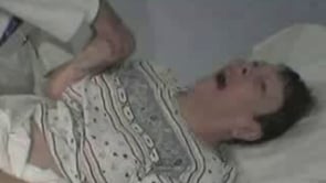 Dystonia and chorea in Huntington disease