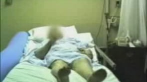 Hemiballism due to stroke, treated with tetrabenazine