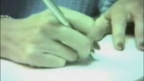 Dystonia (limb) triggered by ulnar fracture and casting