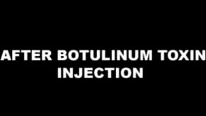 Camptocormia (dystonic) in Parkinson disease helped by botulinum toxin