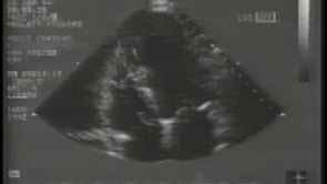 Rgmi2
