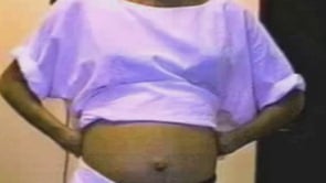 Tourette syndrome with abdominal tic in pregnancy