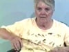 Apraxia of hand movement (1)