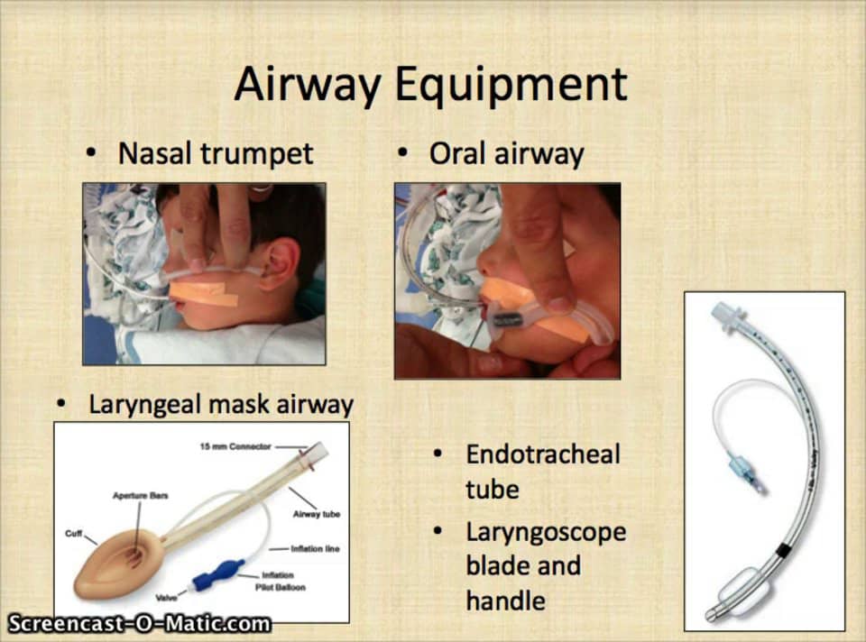 Airway Management in the PACU on Vimeo