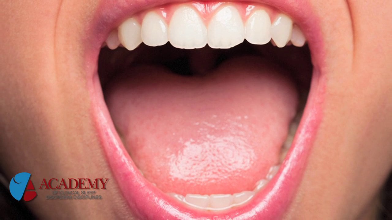 What is Oral Cancer’s Connection to HPV? With Dr. Stuart Rich, Sleep ...