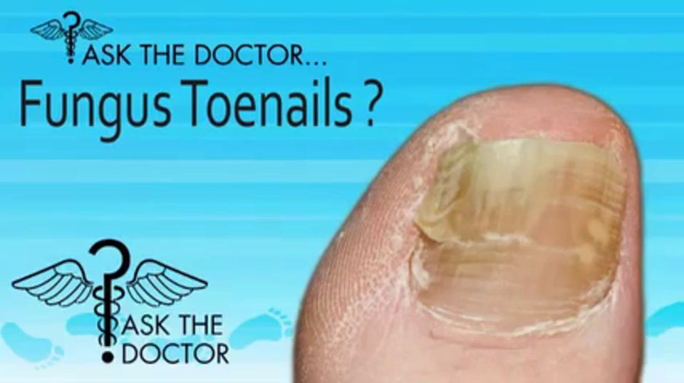 How Do I Know If I Have Fungal Toenails? Podiatrist in Spring Hill